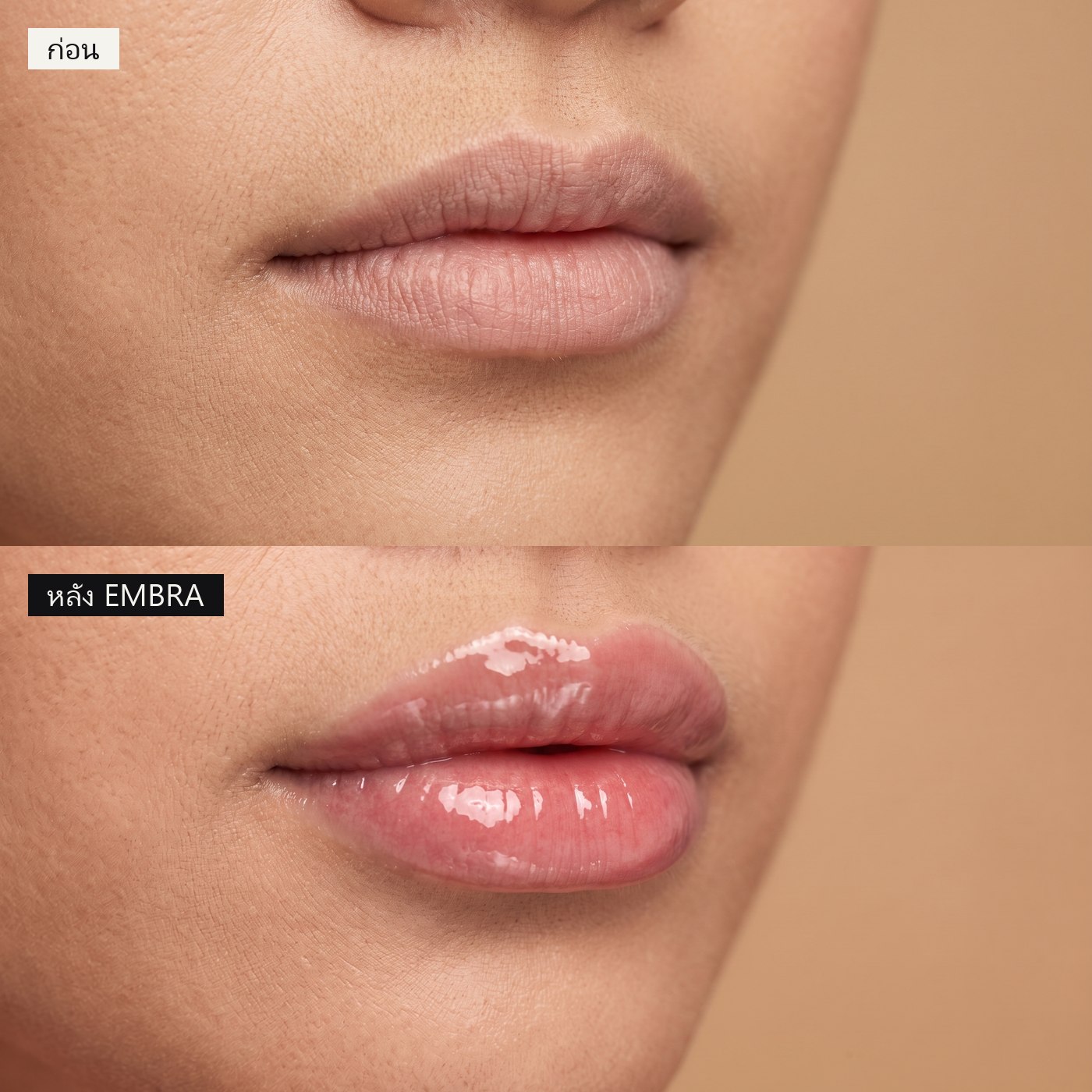 Before and after using EMBRA